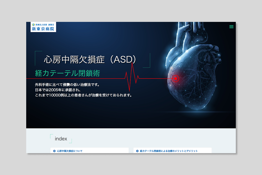 新東京病院_ADS経カテーテル閉鎖術LP